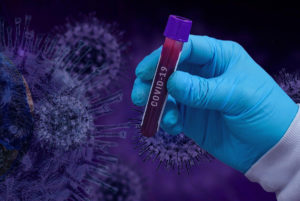Scopri di più sull'articolo Test sierologici per l’identificazione di anticorpi IgM – IgG – SARS-CoV-2 (CoviD19)